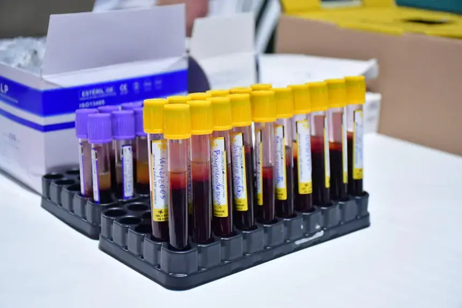 Governo do Amapá garante exames laboratoriais para candidatos do concurso da PM no Hospital de Clínicas Alberto Lima